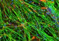 Ученые упростили получение человеческих стволовых клеток мозга