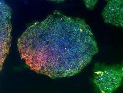Ученые изучили индуцированные стволовые клетки