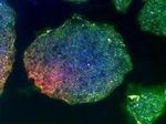 Ученые изучили индуцированные стволовые клетки