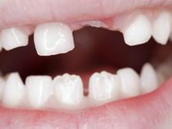 Китайские ученые вырастили зуб из мочи