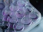 Новый препарат разрушает каркас раковой клетки