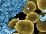 Ученые из США создали универсальный антибиотик