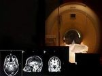 Ученые нашли доступ к памяти человека