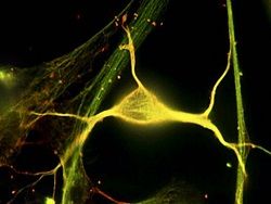 Учёные обнаружили нейроны, подавляющие страх