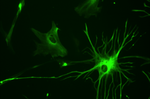 Ученые смогли включить нейрогенез в поврежденном спинном мозге