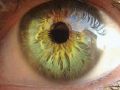 В Японии впервые пересадили сетчатку глаза из стволовых клеток | техномания