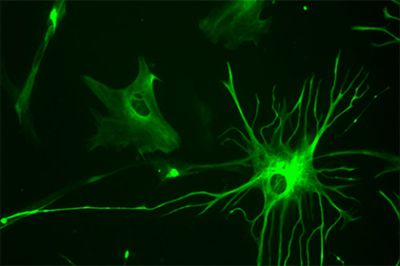 Пересадка клеток из мозга человека изменила умственные способности мышей