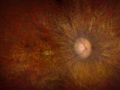 Генотерапия на время исцеляет заболевания сетчатки глаза | техномания