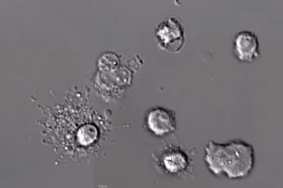 Ученые впервые сняли на видео смерть лейкоцита