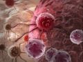 Ученые назвали главную причину возникновения рака | техномания