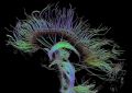 Томография позволит следить за активностью генов мозга | техномания
