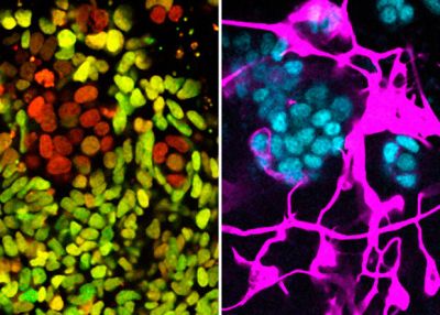 Судьбу стволовых клеток связали с микроРНК