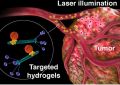 Разработана гидрогелевая наноплатформа для диагностики и лечения рака | техномания