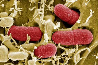 Наночастицы победили бактерии за считаные секунды