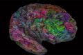 Построена трехмерная карта слов в мозге человека