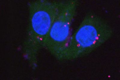 В МГУ научились «подсвечивать» раковые опухоли наночастицами