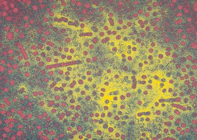 Вирусные гепатиты стали одной из ведущих причин смерти