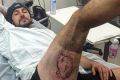 Британскому велосипедисту потребовалась пересадка кожи после взрыва iPhone 6