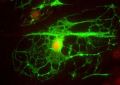 Стимуляция миелинизации нейронов помогла восстановить мозг после инсульта