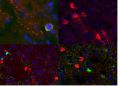Перепрограммирование нейронов поможет бороться с болезнью Паркинсона | техномания