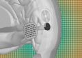 В США испытают на людях восстанавливающий зрение чип. Его имплантируют прямо в мозг