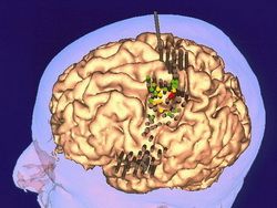 Учёные разгадали, как головной мозг усыпляет мышцы