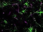 Ученые обнаружили новую систему очистки мозга